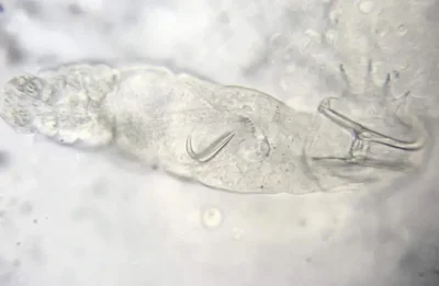 Gill flukes microscopic view 