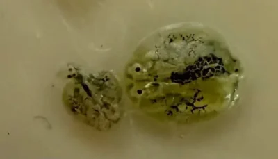 image of a lice
